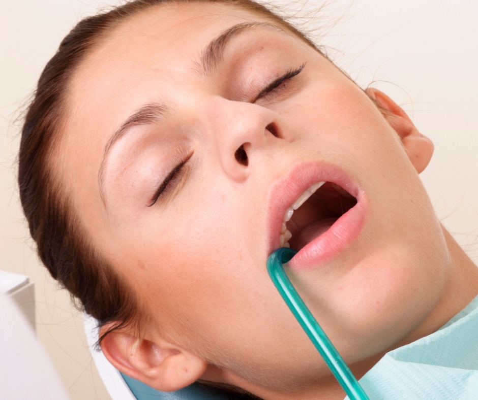 sedation-dentistry