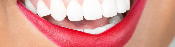 teeth whitening eastlake