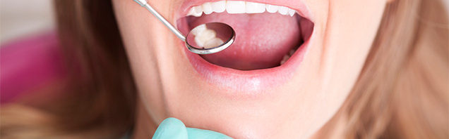 dental filling in chula vista