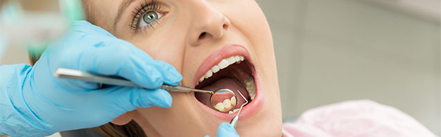 teeth cleaning chula vista