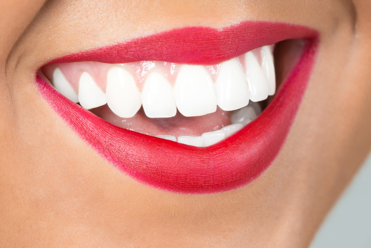 teeth whitening eastlake