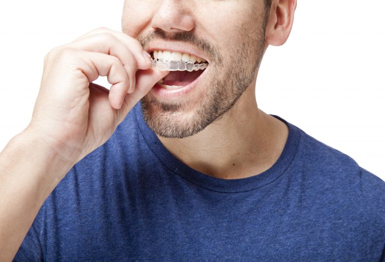 invisalign treatment